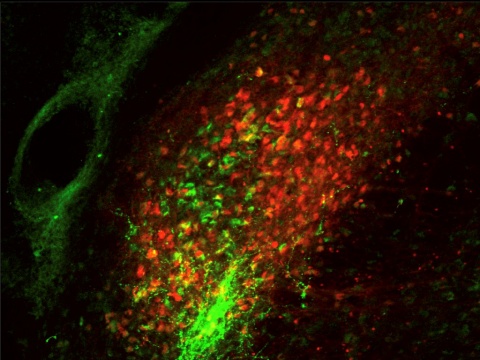 NIH Neuron Image
